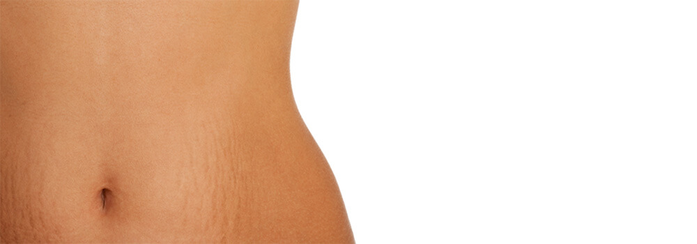 What Are the Best Options for Scar Removal?